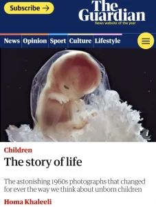 У статті The Guardian «Як насправді виглядає вагітність» стерті ембріони